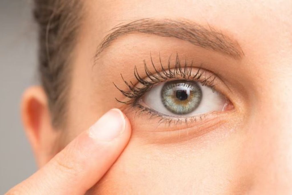 Κριθαράκι στο μάτι: Δείτε τι να κάνετε για να το απομακρύνετε