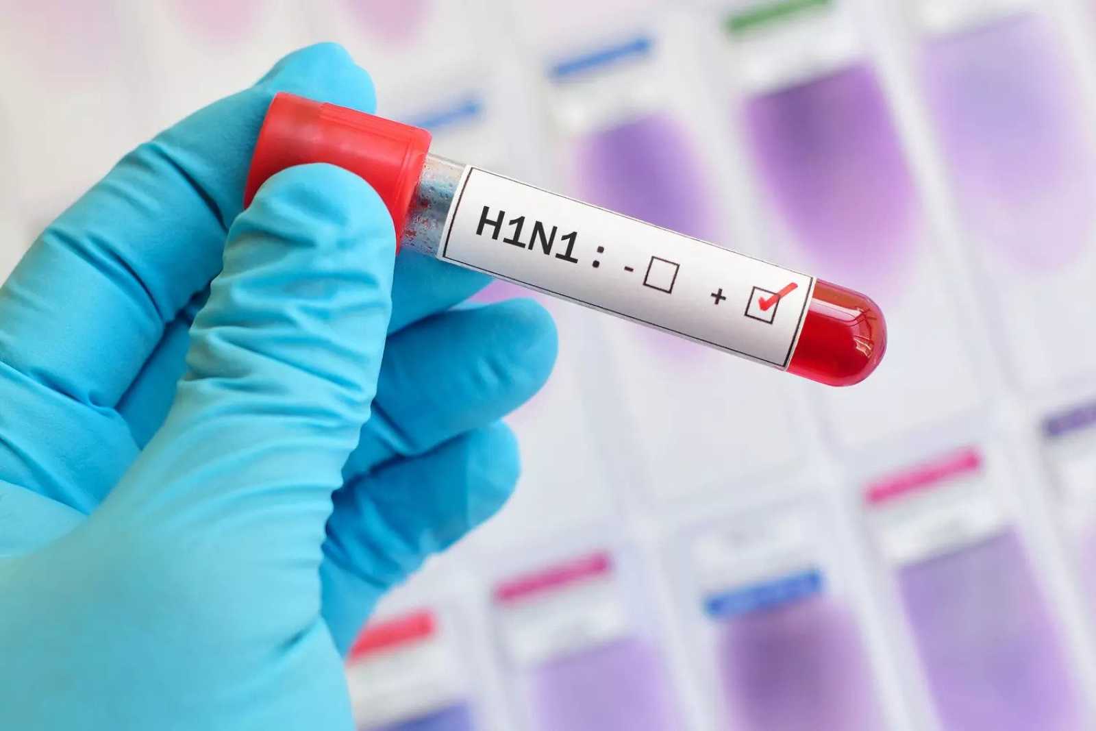 Αυτά είναι τα συμπτώματα της γρίπης Η1Ν1 – Πώς μεταδίδεται