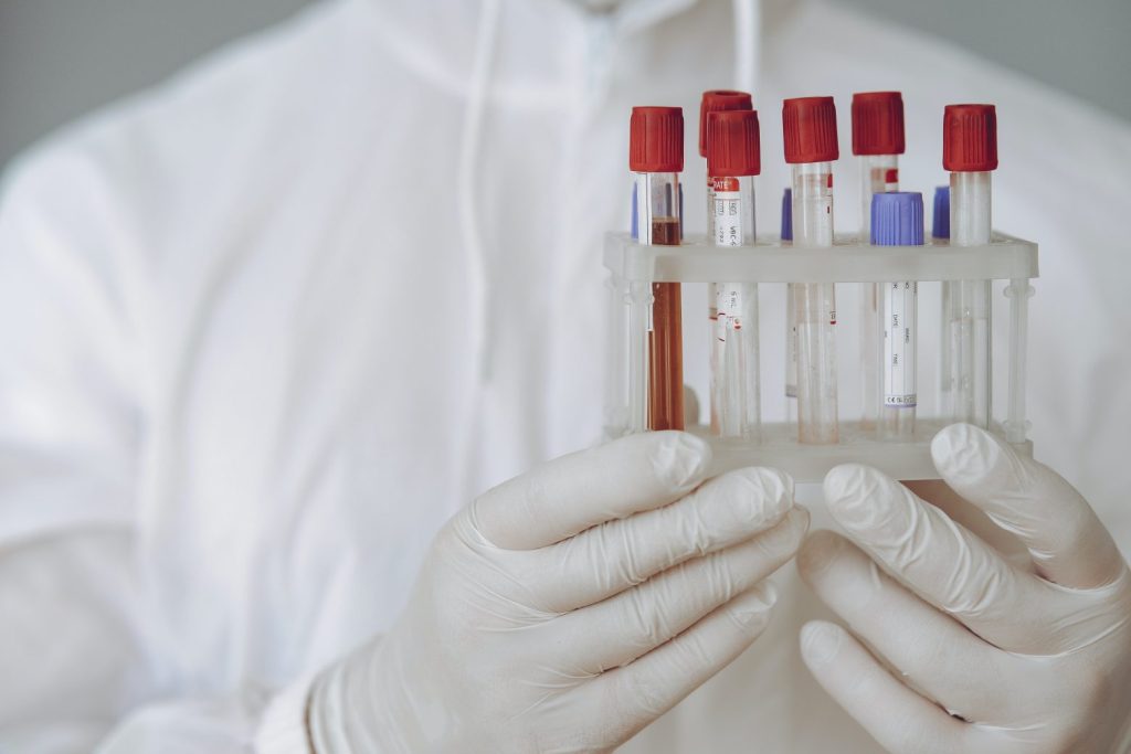 Πώς οι εξετάσεις αίματος μπορούν να προβλέψουν το προσδόκιμο ζωής κάποιου