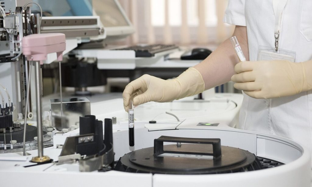 ΗΠΑ: Ερευνητές ανέπτυξαν μέθοδο που ανιχνεύει τον καρκίνο των ωοθηκών από δείγμα ούρων