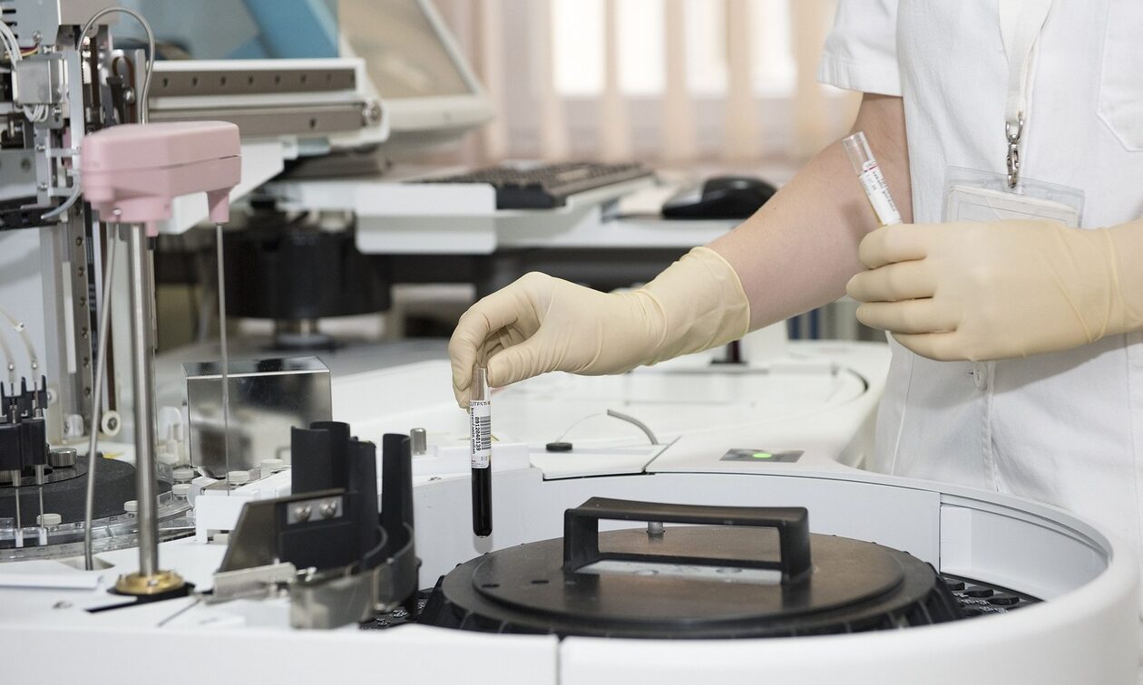 ΗΠΑ: Ερευνητές ανέπτυξαν μέθοδο που ανιχνεύει τον καρκίνο των ωοθηκών από δείγμα ούρων