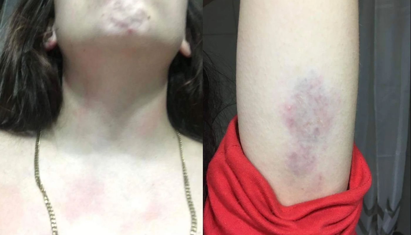 Θεσσαλονίκη: Συνελήφθη 27χρονος που ξυλοκόπησε την 23χρονη μητέρα του παιδιού του – «Θα σε σκοτώσω, θα σε μαχαιρώσω»