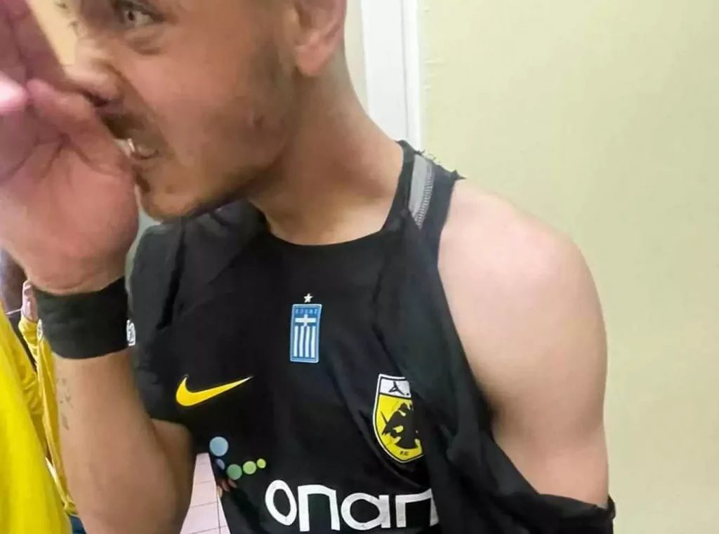 Κοζάνη – ΑΕΚ Β’: Επεισόδια στο τέλος του αγώνα – Επιτέθηκαν σε παίκτη της Ένωσης