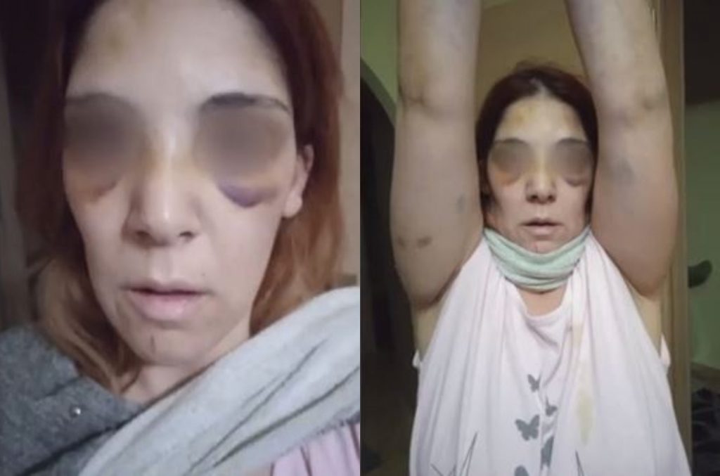 Άργος: «Έβαλε το μαχαίρι στο λαιμό μου – Μου είπε “θα χύσεις αίμα”» – Σοκάρουν οι περιγραφές της 32χρονης