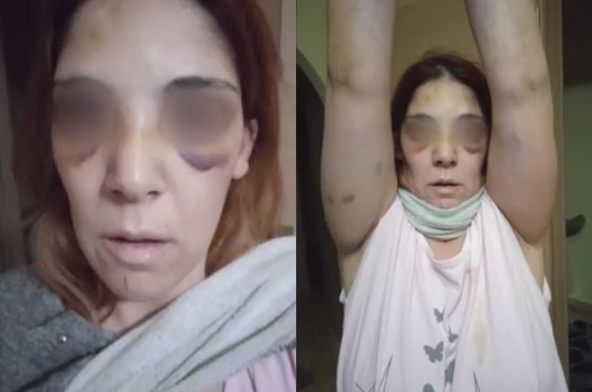 Άργος: «Έβαλε το μαχαίρι στο λαιμό μου – Μου είπε “θα χύσεις αίμα”» – Σοκάρουν οι περιγραφές της 32χρονης