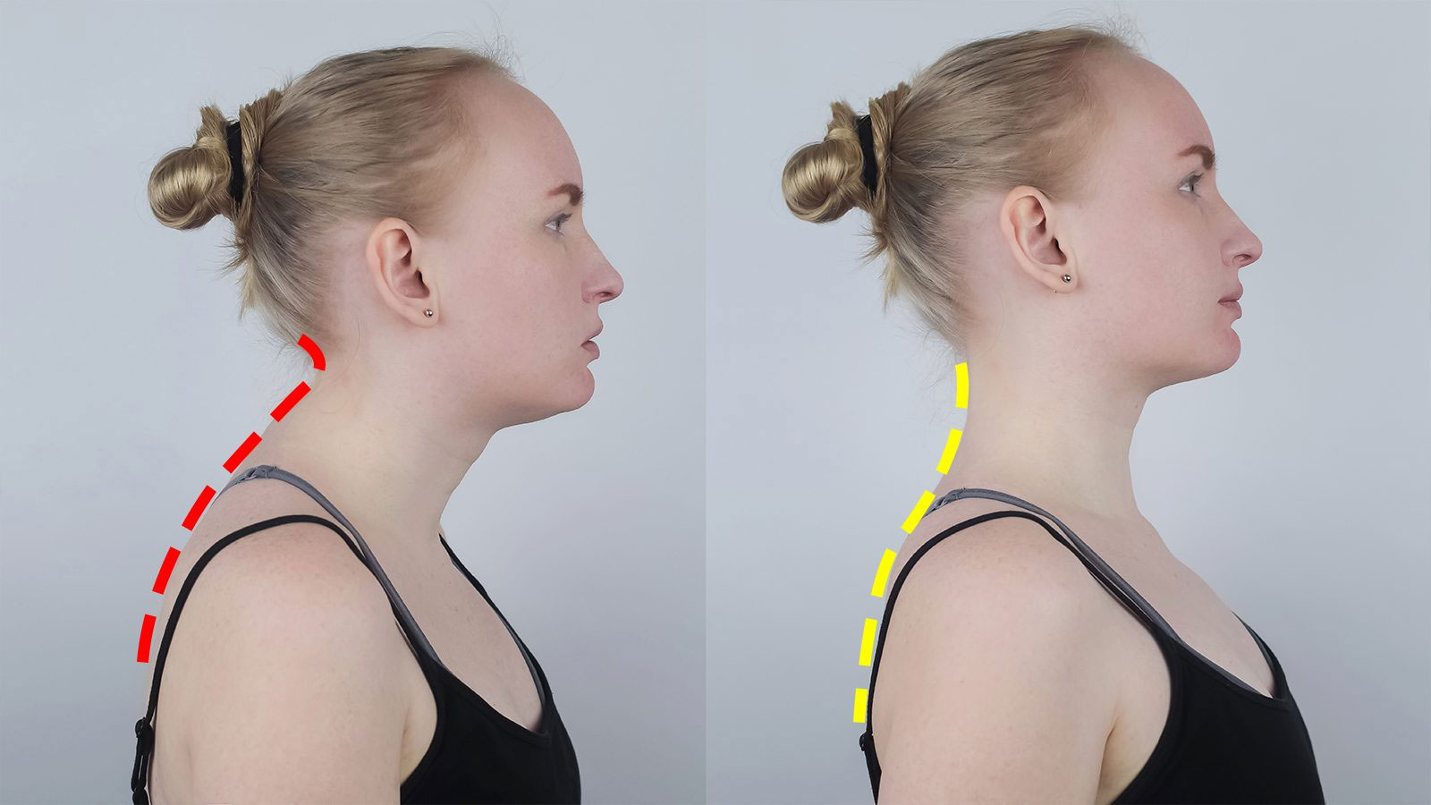 Για ποιο λόγο η καλή στάση του σώματος είναι σημαντική