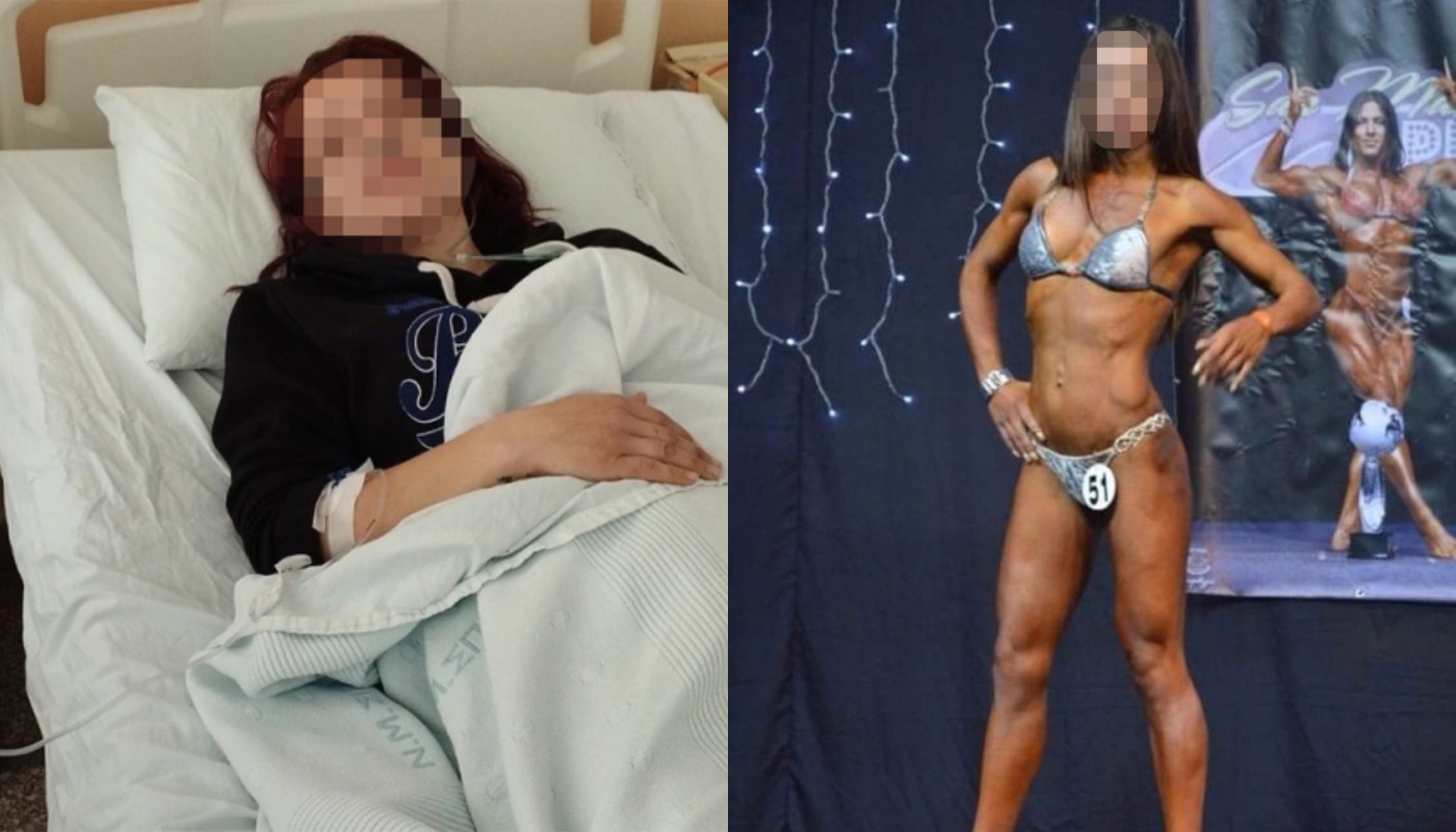 Σπάρτη: Πρώην bodybuilder έπεσε θύμα ξυλοδαρμού από τον σύζυγό της – «Με χτυπούσε στο πάτωμα με μανία» (φώτο)