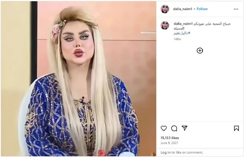 Ιρακινή παρουσιάστρια έκανε 43 πλαστικές για να γίνει «Barbie» – «Μοιάζει με εξωγήινο» [ΦΩΤΟ]