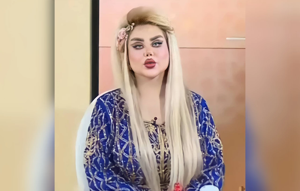 Ιρακινή παρουσιάστρια έκανε 43 πλαστικές για να γίνει «Barbie» – «Μοιάζει με εξωγήινο» (φωτο)