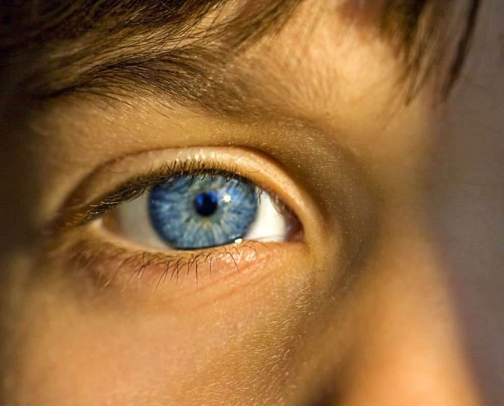 Όσα πρέπει να ξέρετε για την ετεροχρωμία: Δείτε γιατί κάποιοι έχουν διαφορετικό χρώμα ίριδας σε κάθε μάτι