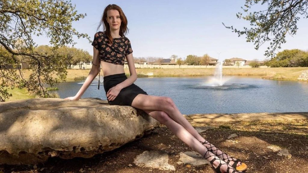 Αυτή είναι η γυναίκα με τα ψηλότερα πόδια στον κόσμο – «Mε συγκρίνουν με ήρωες από ταινίες τρόμου»