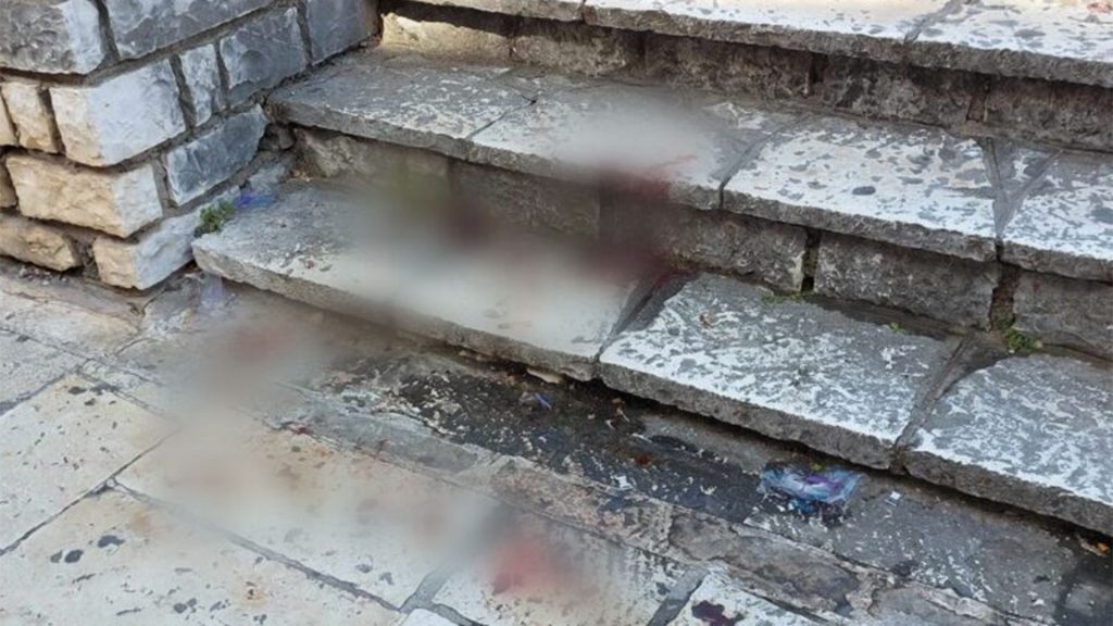 Κέρκυρα – Πατέρας 17χρονου που μαχαιρώθηκε: «Ο γιος μου δεν γνώριζε καν τον δράστη»
