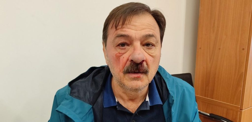 Βόλος: Μασκοφόρος επιτέθηκε σε δημοτικό σύμβουλο – Τι αποκαλύφθηκε όταν τον ακινητοποίησαν