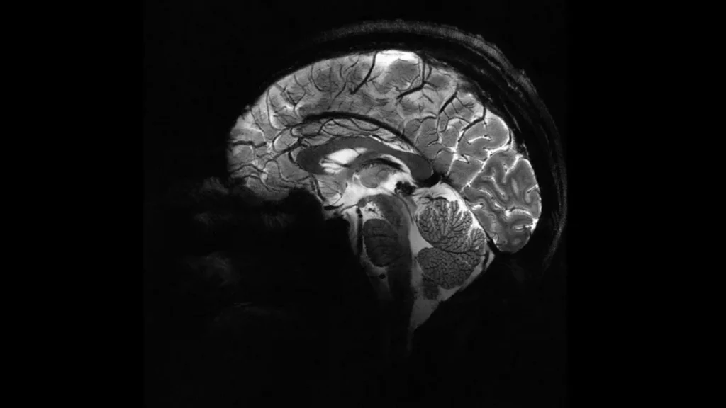 Στη δημοσιότητα οι πρώτες εικόνες εγκεφάλου από τον ισχυρότερο μαγνητικό τομογράφο στον κόσμο