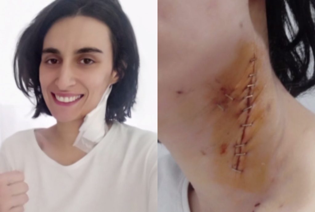 Σοκαριστική μαρτυρία θύματος ενδοοικογενειακής βίας – «Με μαχαίρωσε στο λαιμό» 