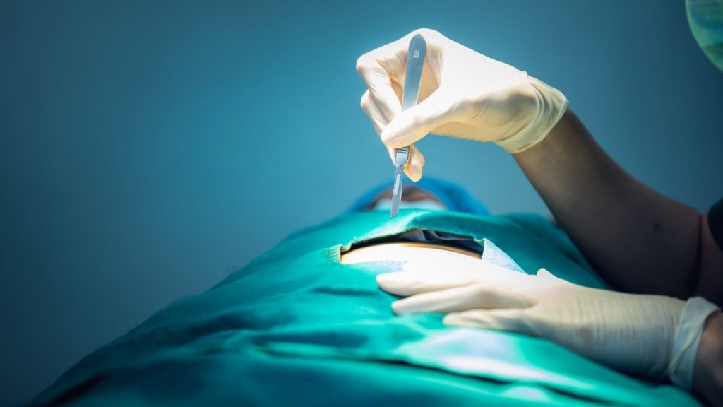 Κόρινθος: Νεκρός μετά από χειρουργείο στη χολή 60χρονος – Ξέχασαν ιατρικό εργαλείο στην κοιλιά του