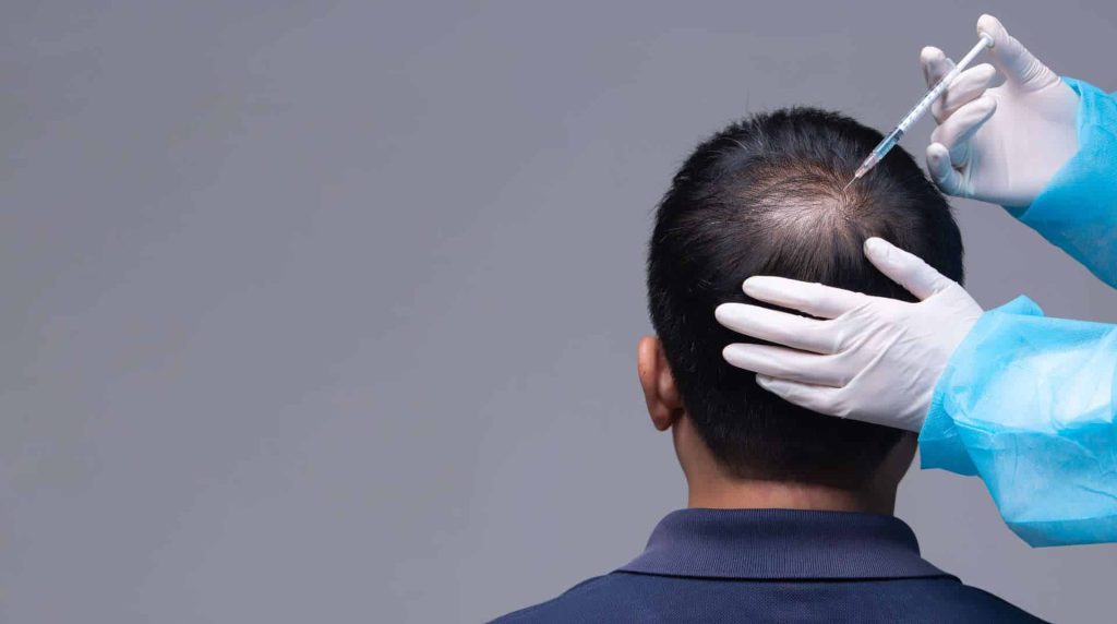 Ιατρείο για αφροδίσια νοσήματα διενεργούσε εμφύτευση μαλλιών – Δεν υπήρχε εξειδικευμένο προσωπικό