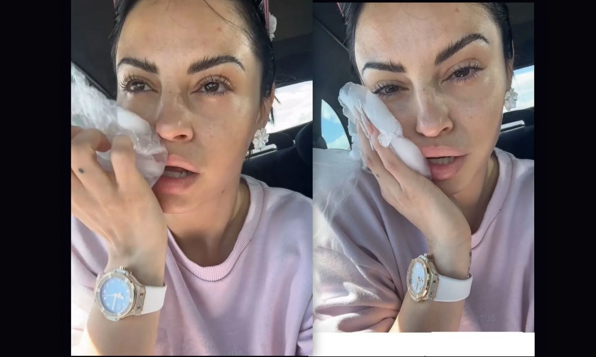 Ατύχημα στον δρόμο για τη Δ.Αλεξανδράκη: «Προσγειώθηκε η μπάρα στο κεφάλι μου – Σκίστηκαν τα χείλη μου» (φωτο)