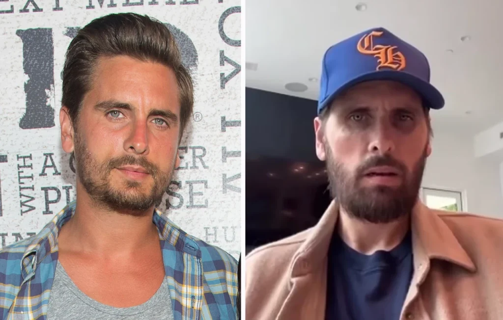 Ο Σ.Ντίσικ σταμάτησε το Ozempic μετά από μεγάλη απώλεια κιλών – «Ζήτησα βοήθεια από διατροφολόγο»