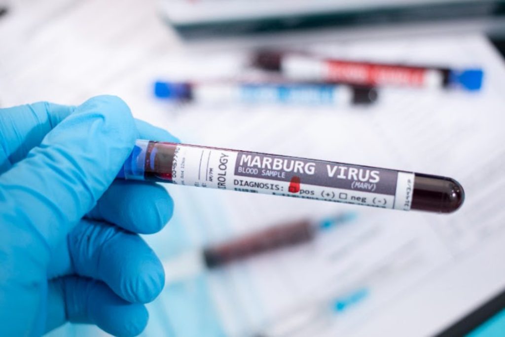 Μπορεί η επόμενη πανδημία να προκύψει από τον ιό Μάρμπουργκ; – Τα συμπτώματα και ο τρόπος μετάδοσης
