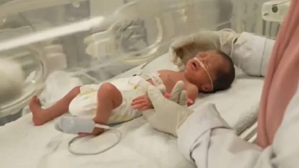 Γάζα: Έχασε τη ζωή του το κοριτσάκι που γεννήθηκε με καισαρική μετά τον θάνατο της μητέρας του στη Ράφα