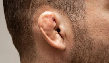 Το «αυτί-κουνουπίδι» – Για ποιο λόγο τα αυτιά των παλαιστών έχουν αυτό το περίεργο σχήμα