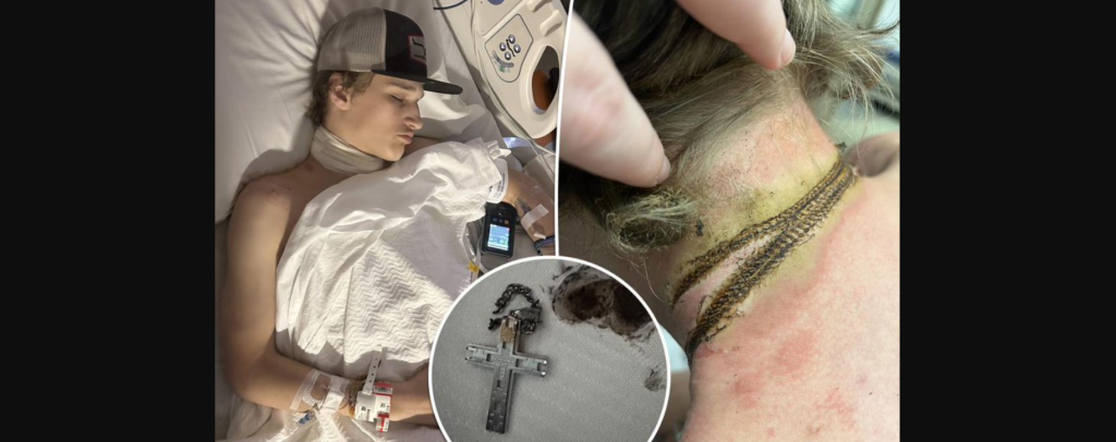 Οκλαχόμα: 16χρονος έπαθε ηλεκτροπληξία από τον σταυρό του και κόντεψε να πεθάνει