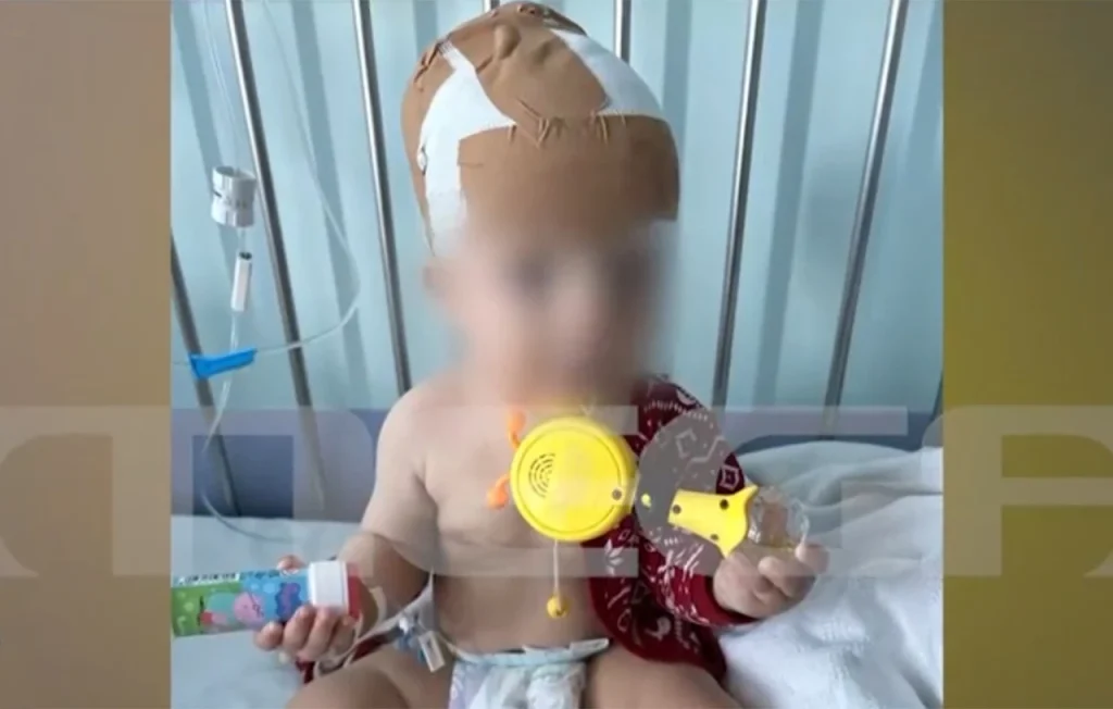 Νέα Σμύρνη: «Το έχει δαγκώσει στο κεφάλι του» λέει ο πατέρας του 11 μηνών μωρού που του επιτέθηκε σκύλος (βίντεο) 