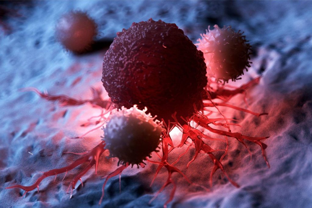 Βασικοκυτταρικό καρκίνωμα: Δείτε ποια είναι τα συμπτώματα και οι παράγοντες κινδύνου – Η θεραπεία