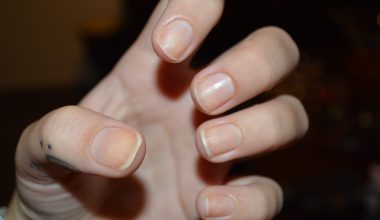Τις γνωρίζατε; – Οι αλλαγές στα νύχια που είναι σημάδι καρκίνου