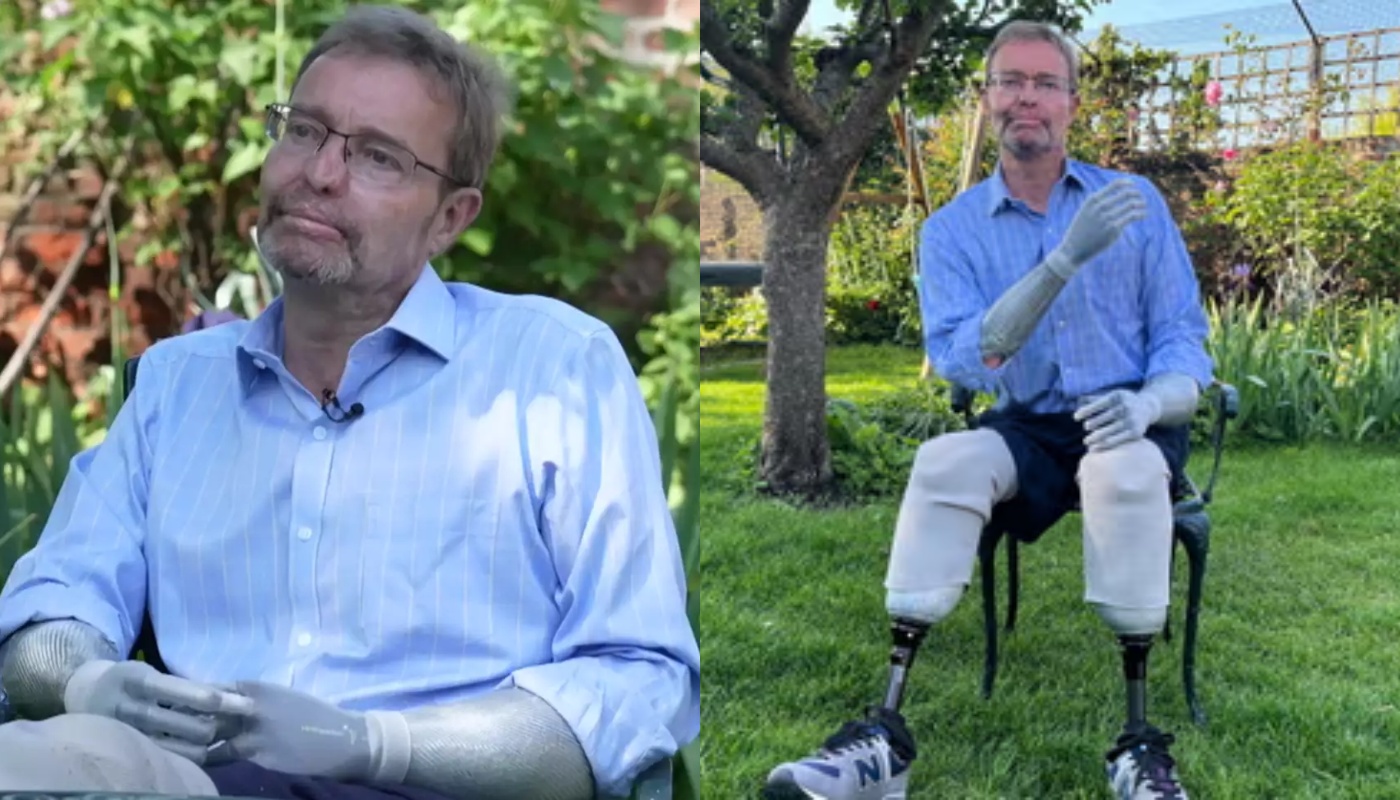 C.Mackinlay: «Μου ακρωτηρίασαν λόγω σηψαιμίας τα χέρια και τα πόδια – Θέλω να γίνω ο πρώτος βιονικός βουλευτής» (βίντεο)