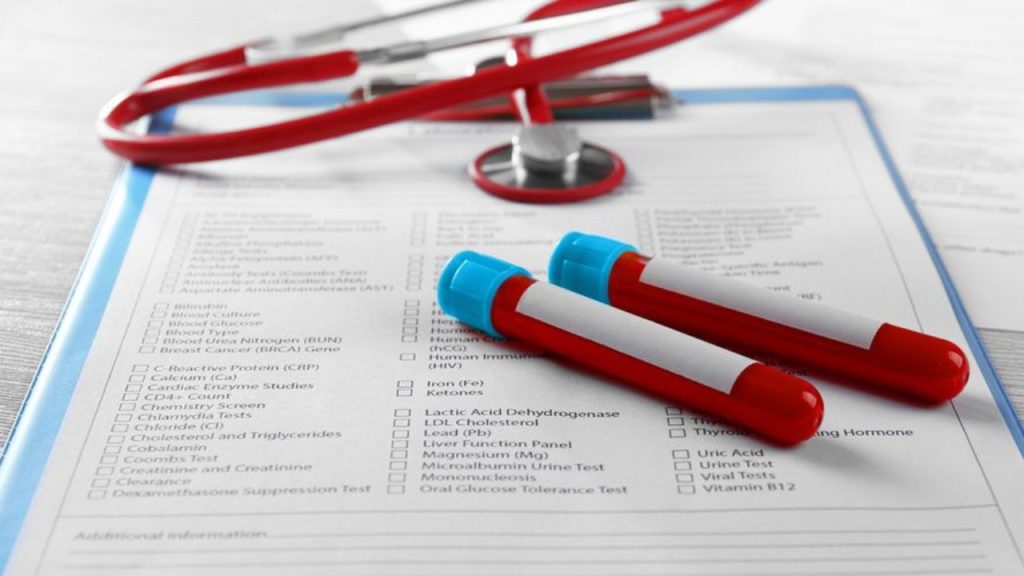 ΕΟΠΥΥ: Δείτε ποιοι εξαιρούνται από τo «χαράτσι» του 1 και των 3 ευρώ στις διαγνωστικές εξετάσεις