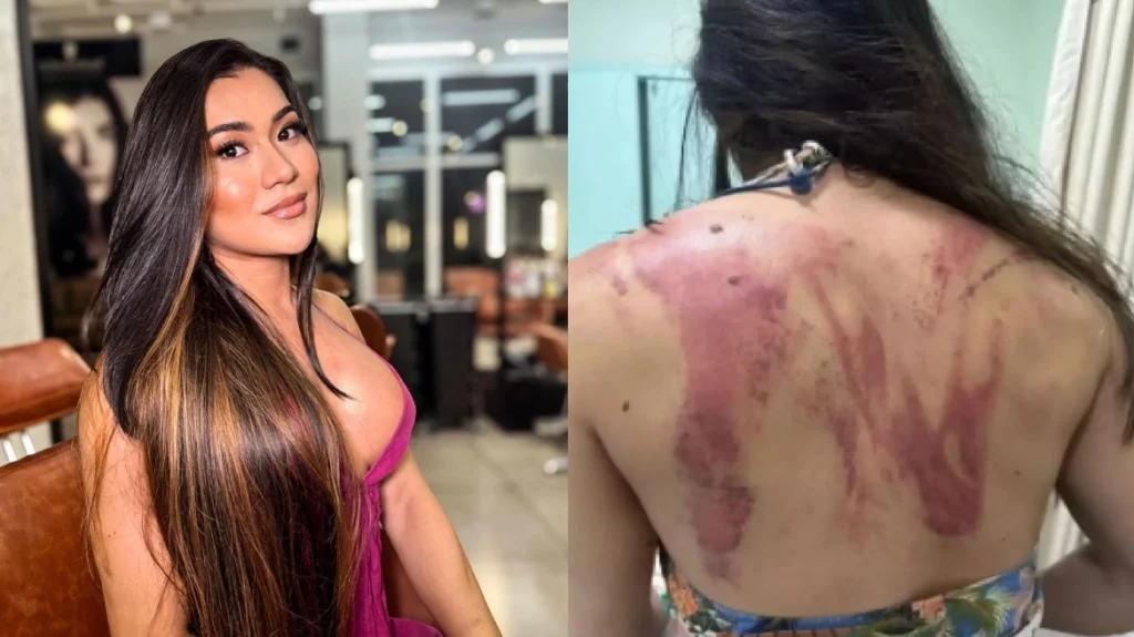 Βραζιλία: Influencer δέχτηκε χτυπήματα με ματσέτα από τον πατέρα της επειδή αρνήθηκε να του δώσει… 165 ευρώ