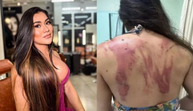 Βραζιλία: Influencer δέχτηκε χτυπήματα με ματσέτα από τον πατέρα της επειδή αρνήθηκε να του δώσει… 165 ευρώ