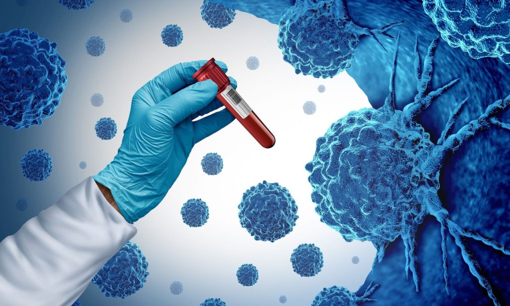 Λευχαιμία: Αυτά είναι τα σημάδια που δεν πρέπει να αγνοήσετε