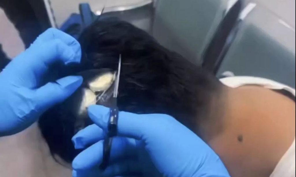 Κολομβιανός έκρυψε κοκαΐνη στην περούκα του για να μην τον αντιληφθούν στο αεροδρόμιο – Δείτε βίντεο