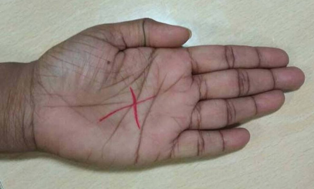 Μήπως έχετε το γράμμα «Χ» στην παλάμη σας; – Όσα πρέπει να γνωρίζετε (βίντεο)
