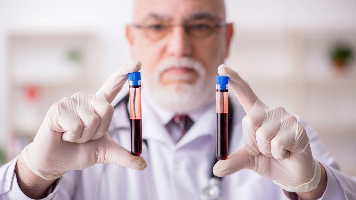 Ανοσοσφαιρίνες: Ποιοι τύποι υπάρχουν και ποιες οι αιτίες των αυξημένων επιπέδων