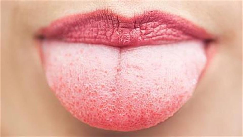 Αυτοί είναι οι επτά λόγοι που πρέπει να καθαρίζετε τη γλώσσα σας κάθε μέρα