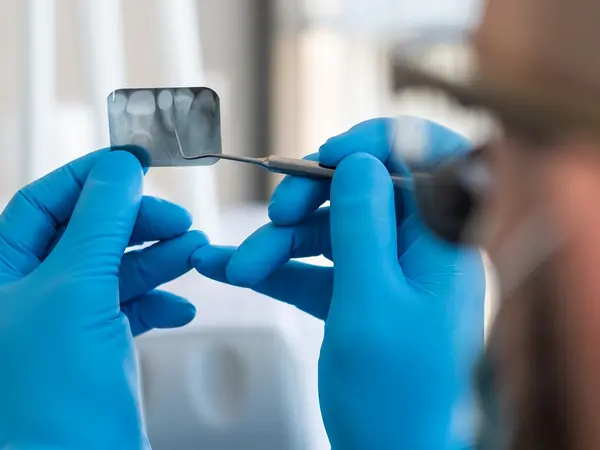 Αντίο στα εμφυτεύματα; Επιστήμονες «καλλιεργούν» ανθρώπινα δόντια στο εργαστήριο