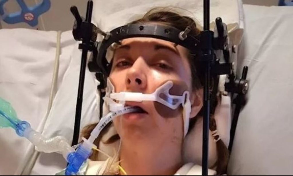 Η ιστορία της 35χρονης γυναίκας που υποβλήθηκε σε χειρουργείο 37 φορές για την συγκόλληση του κρανίου της (φωτο)