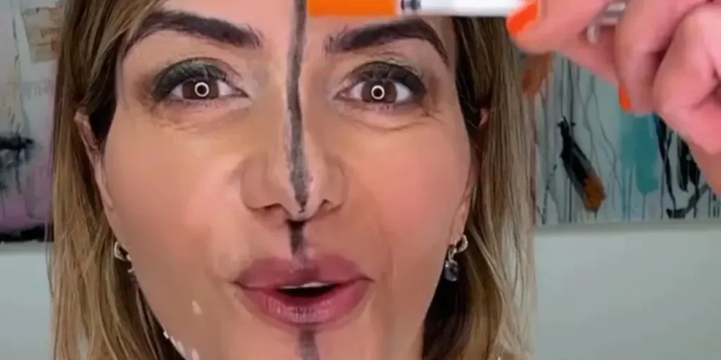 Γιατρός έκανε botox μόνο στη μία πλευρά του προσώπου της για να δείξει τη διαφορά – Αυτό είναι το αποτέλεσμα 