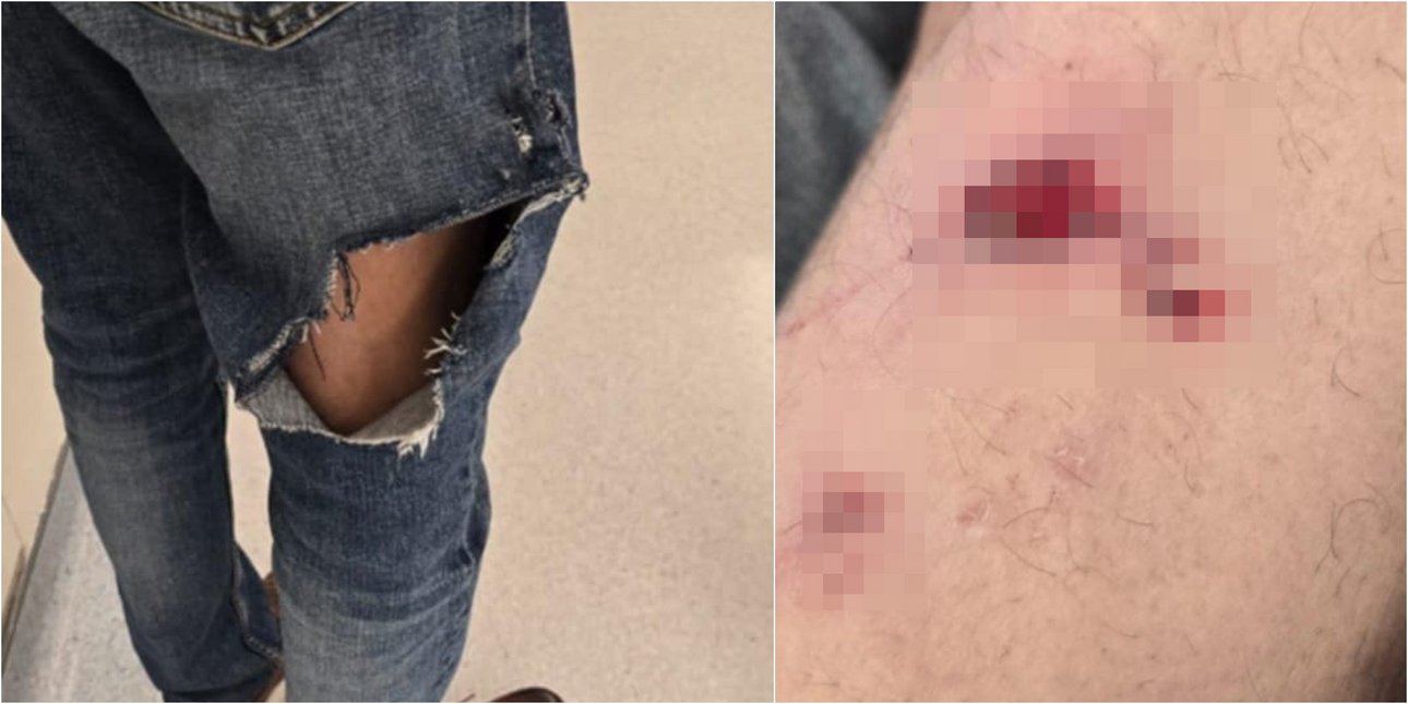 Επίθεση σκύλου στη Βουλιαγμένη – Αυτόπτης μάρτυρας: «Ήταν η μητέρα του Στέφανου Τσιτσιπά όχι η δίδυμη αδελφή της»