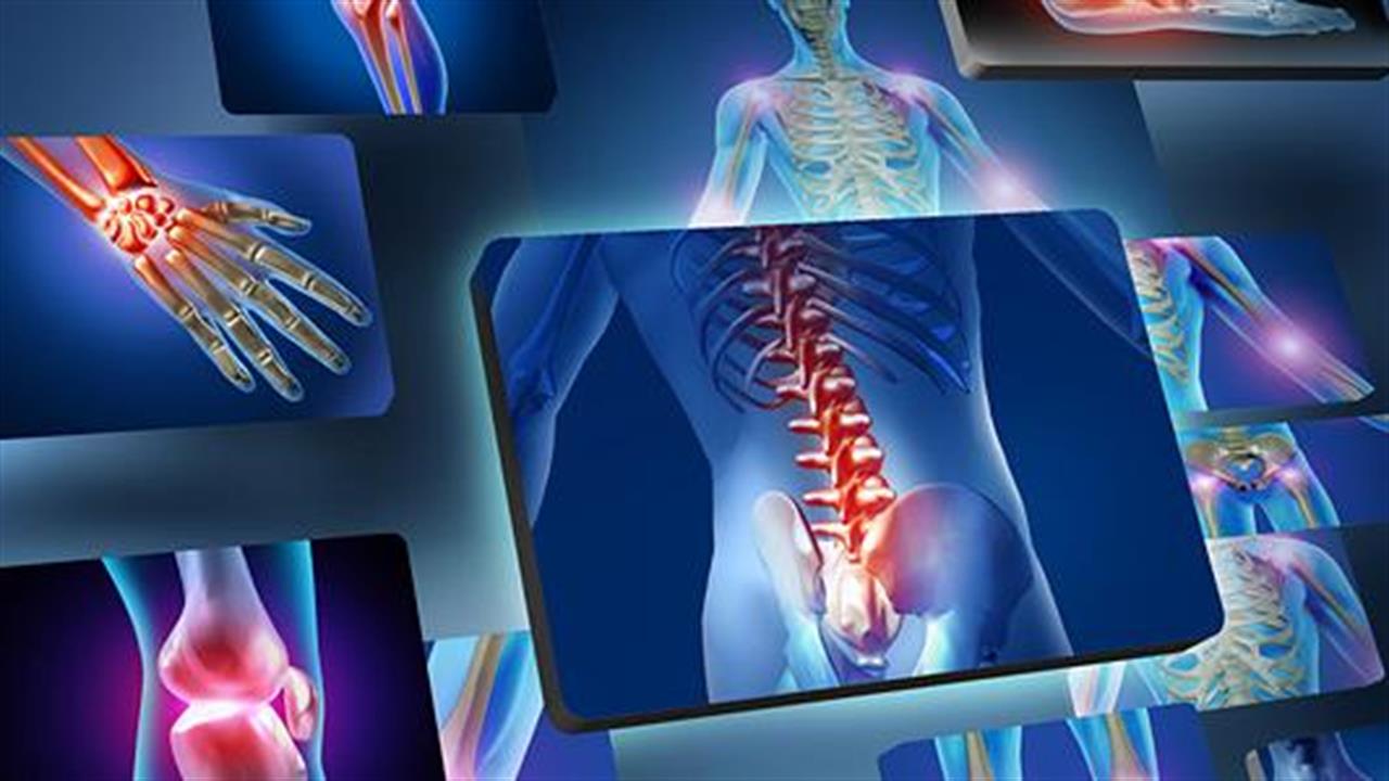 Αυτό είναι το φρούτο που προλαμβάνει την οστεοπόρωση: Η ιδανική ποσότητα