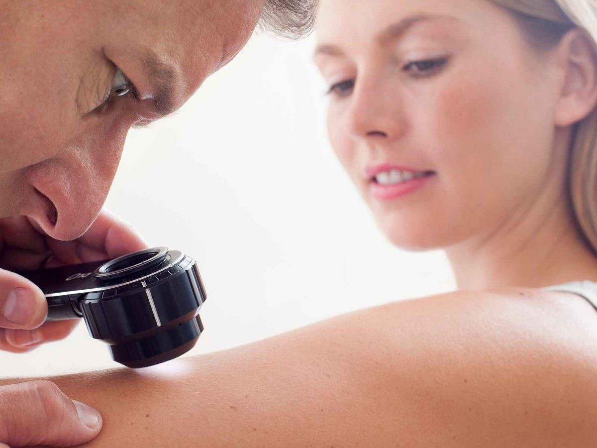 Ηλιακή κηλίδα ή καρκίνος του δέρματος; Δείτε πώς να τα ξεχωρίσετε