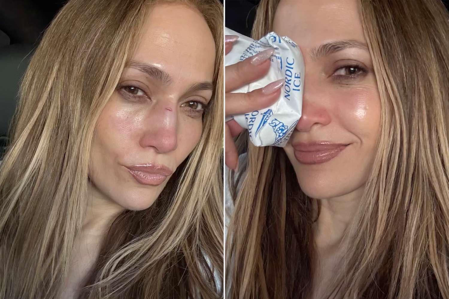 Η Τζένιφερ Λόπεζ τραυματίστηκε κατά τη διάρκεια πρόβας – Δείτε φωτογραφίες