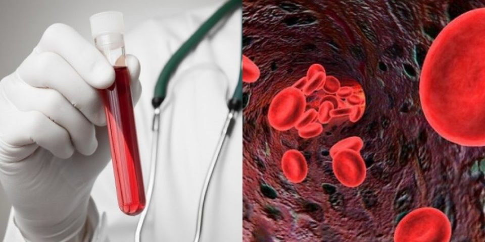 Φυσιολογικές και επικίνδυνες τιμές αιματοκρίτη – Πότε μπορεί να οδηγήσουν σε θάνατο