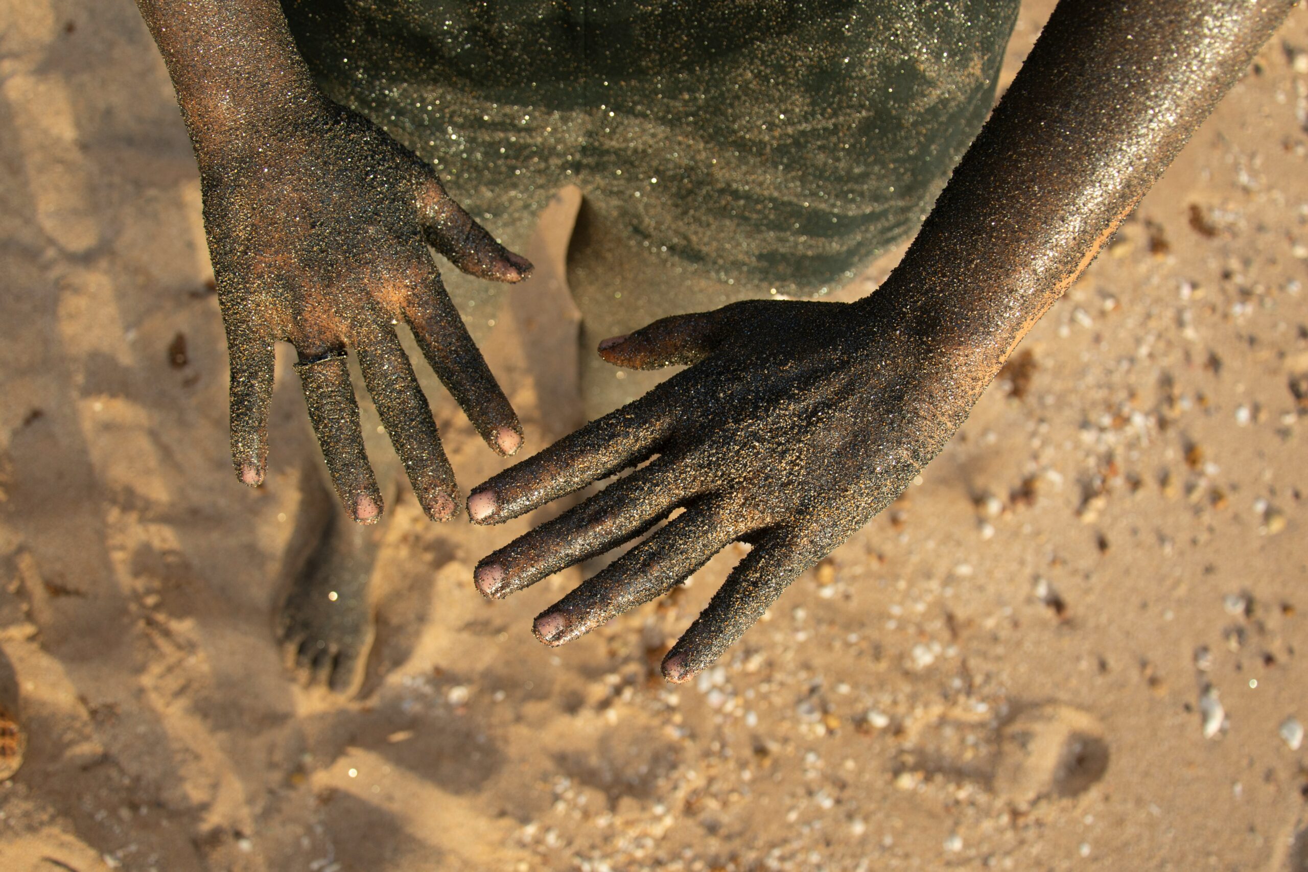 Σουδάν: 70 άνθρωποι έχασαν τη ζωή τους από χολέρα μέσα σε δύο ημέρες