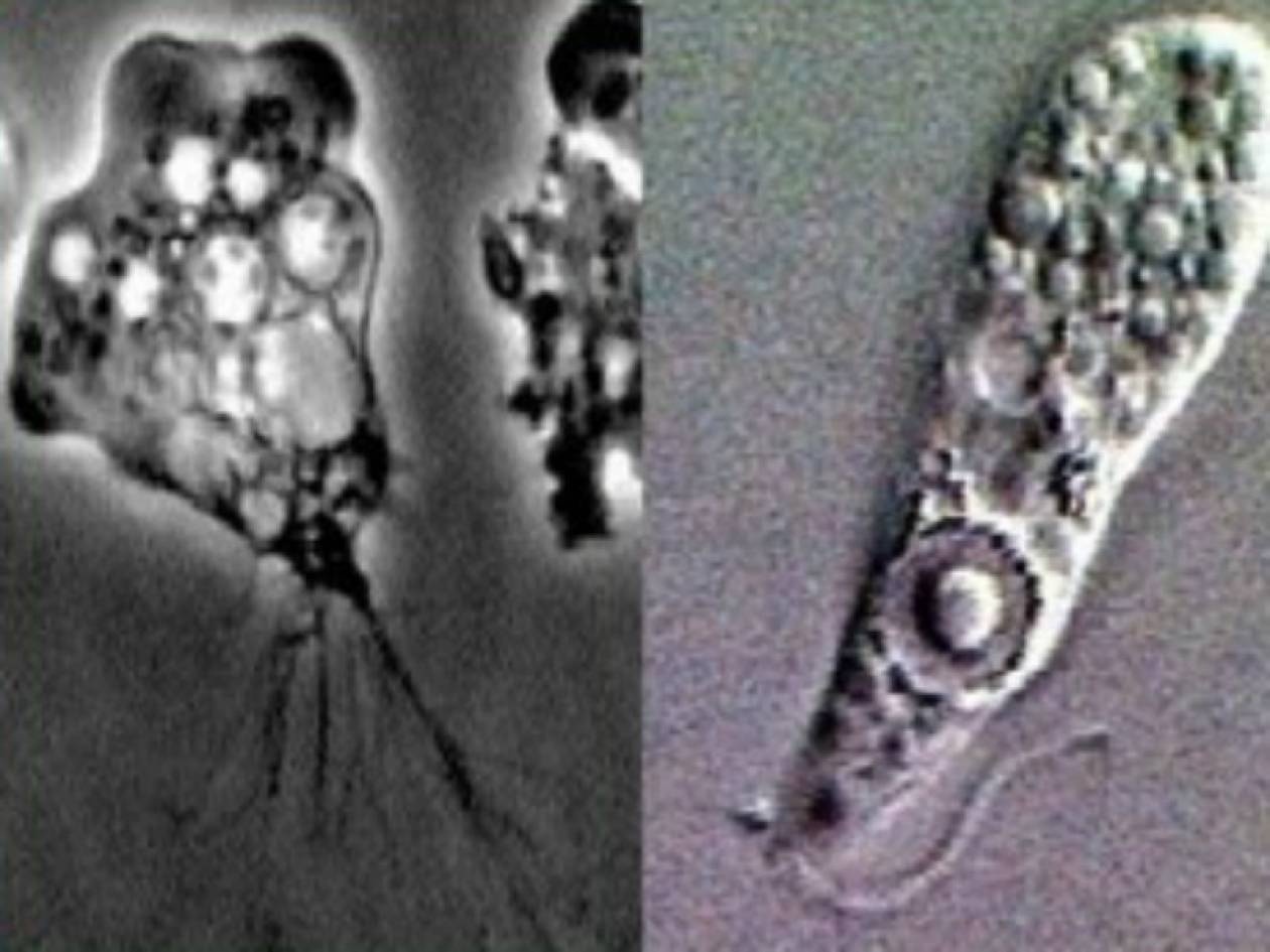 ΗΠΑ: Νεκρή 71χρονη από αμοιβάδα που τρώει τον εγκέφαλο – Το μοιραίο λάθος που έκανε σε κάμπινγκ