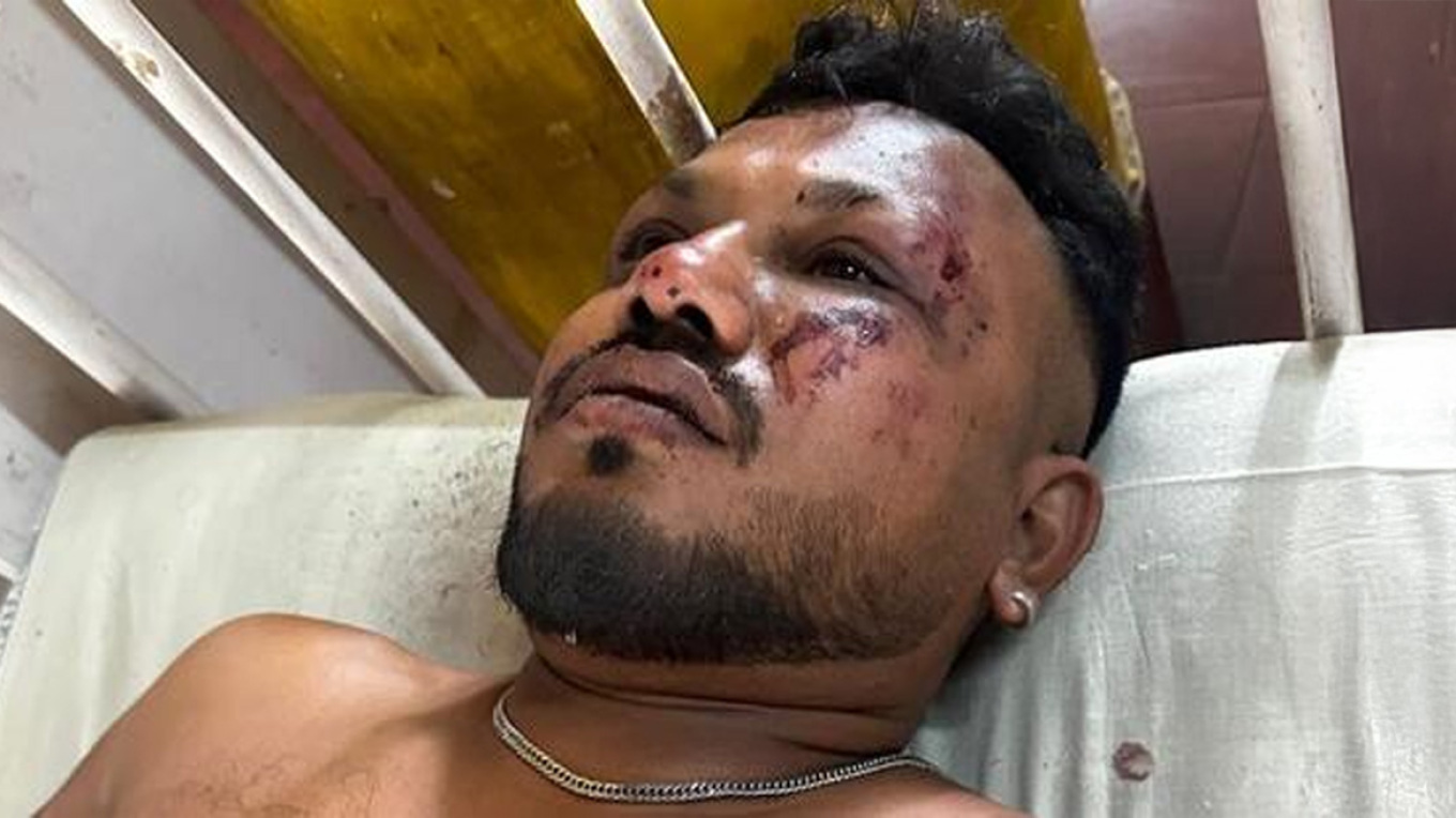 Συγκλονίζει ο μοναδικός επιζών της αεροπορικής τραγωδίας: «Δεν ξέρω πώς επέζησα – Γύρω μου έβλεπα παντού πτώματα»